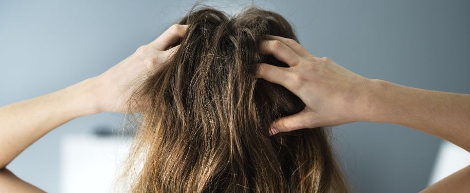 The Best Remedies for Dry Scalp in the Winter